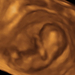 10 hetes magzat ultrahang képe - CsodaBent 4d ultrahang