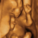 16 hetes magzat ultrahang képe - CsodaBent 4d ultrahang