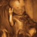 19 hetes magzat ultrahang képe - CsodaBent 4d ultrahang