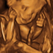 21 hetes magzat ultrahang képe - CsodaBent 4d ultrahang