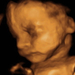 23 hetes magzat ultrahang képe - CsodaBent 4d ultrahang