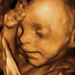 24 hetes magzat ultrahang képe - CsodaBent 4d ultrahang