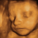 27 hetes magzat ultrahang képe - CsodaBent 4d ultrahang