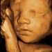 28 hetes magzat ultrahang képe - CsodaBent 4d ultrahang