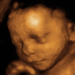 29 hetes magzat ultrahang képe - CsodaBent 4d ultrahang