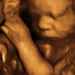 33 hetes magzat ultrahang képe - CsodaBent 4d ultrahang