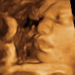 40 hetes magzat ultrahang képe - CsodaBent 4d ultrahang