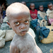 rwandan refugee boy in goma (Medium)