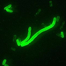 250px-Yersinia pestis fluorescent