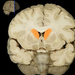 3. Törzsducok -red nucleus amygdala-Mars