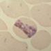 plasmodium malariae2 (Ho)